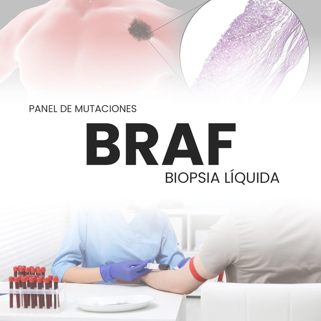 Panel de mutaciones BRAF (Biopsia Líquida)