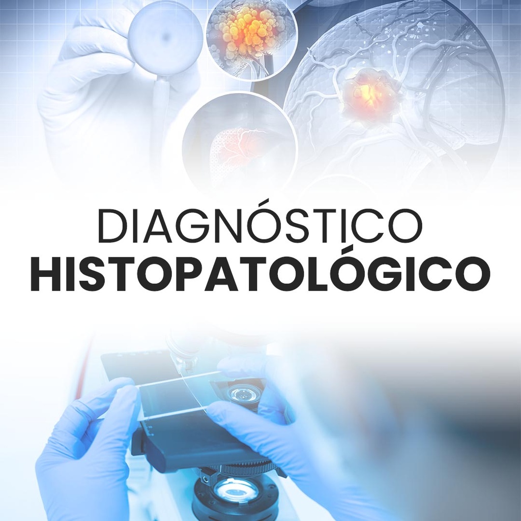 Diagnóstico histopatológico