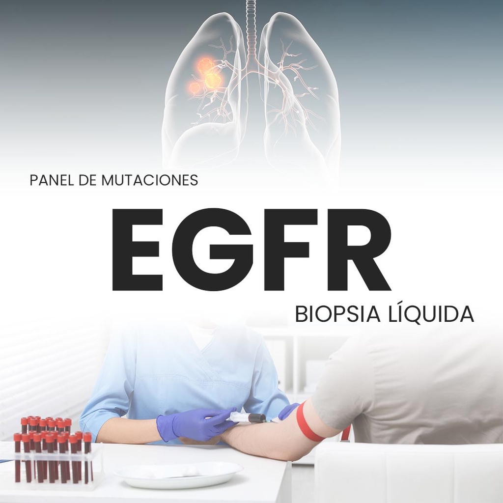 Panel de mutaciones EGFR (Biopsia Líquida)