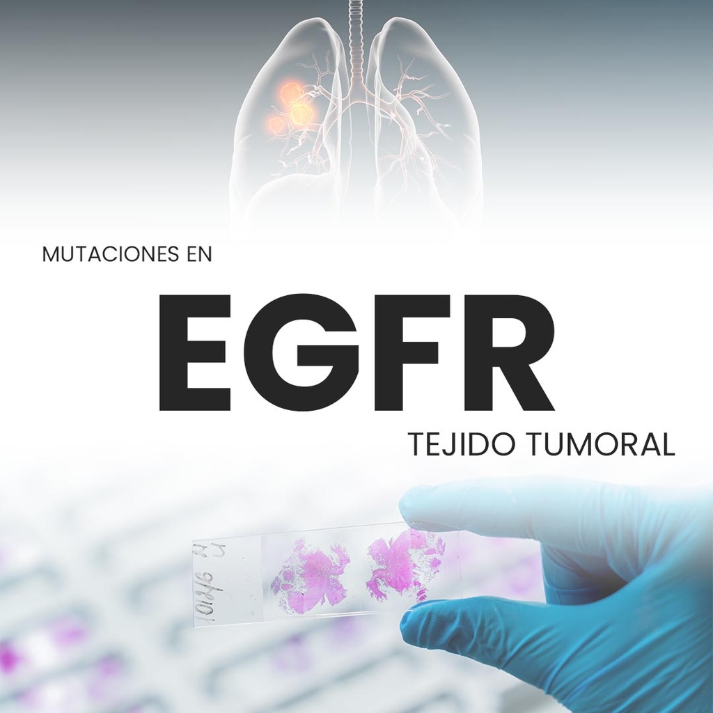Mutaciones en EGFR (Tejido tumoral)