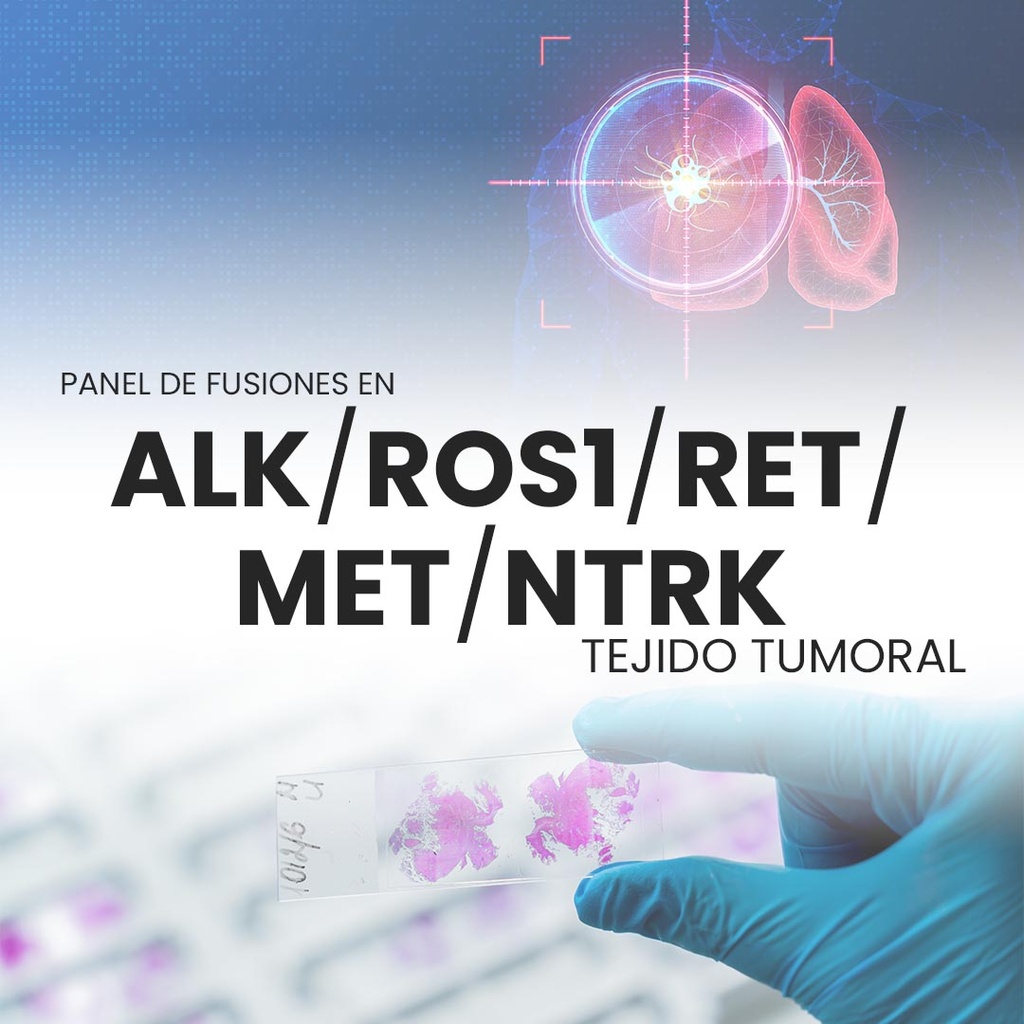 Panel de fusiones en ALK/ROS1/RET/MET y NTRK (Tejido tumoral)