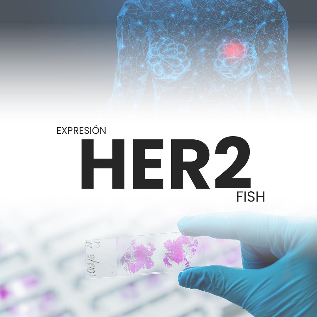 Amplificación HER2 (FISH)