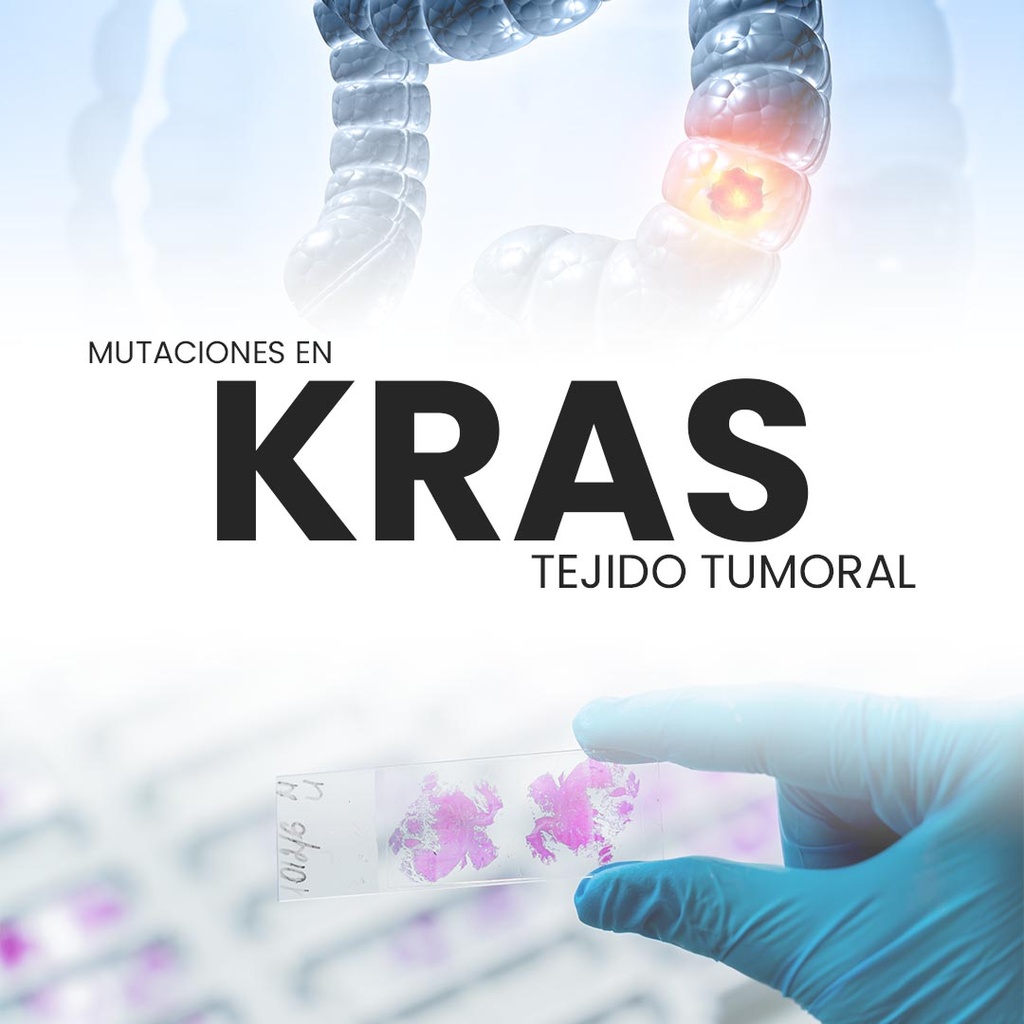 Mutaciones en KRAS (Tejido tumoral)