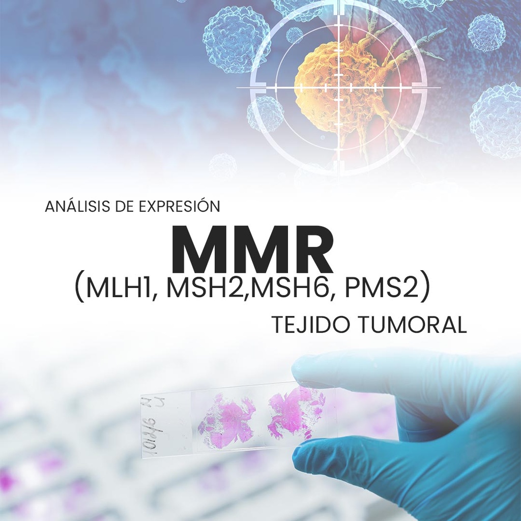 Análisis de expresión MMR (MLH1, MSH2, MSH6, PMS2)