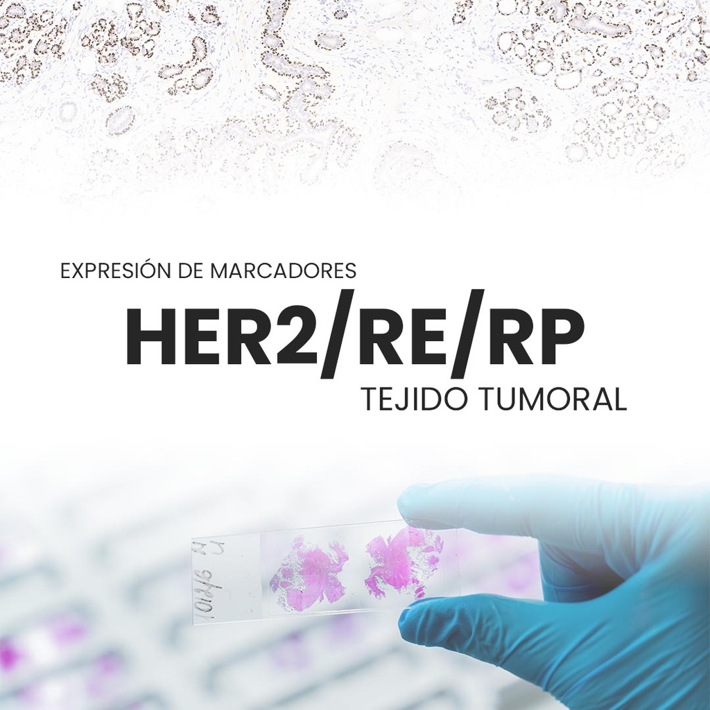 Expresión de marcadores HER2/RE/RP (Tejido tumoral)