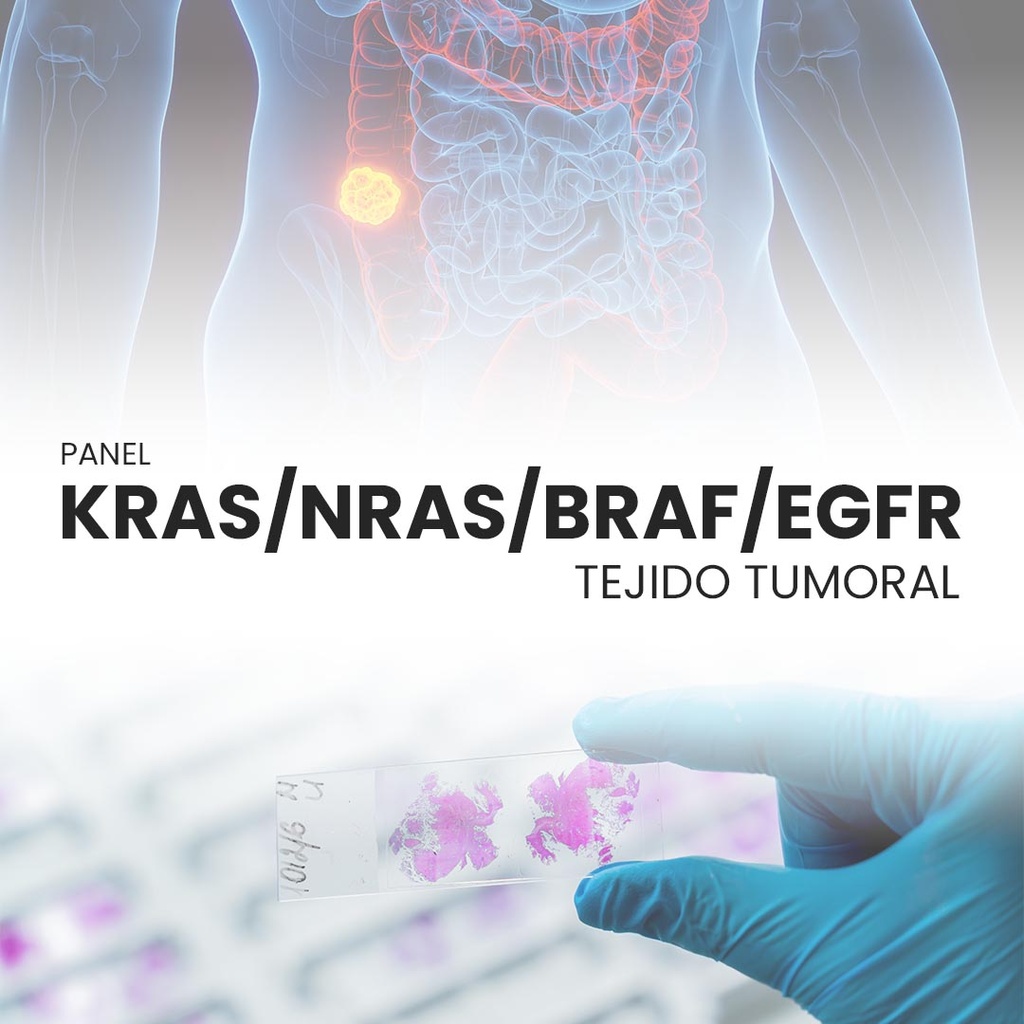 Panel KRAS/NRAS/BRAF/EGFR (Tejido tumoral)