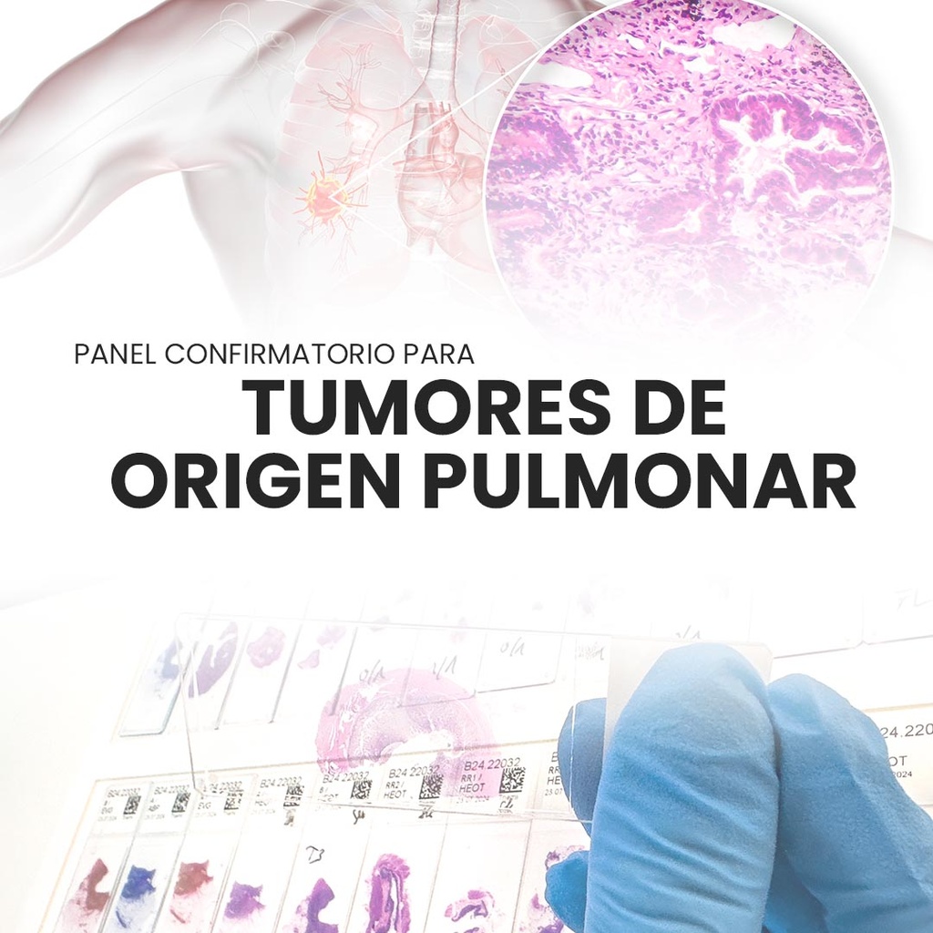 Panel confirmatorio para pulmón