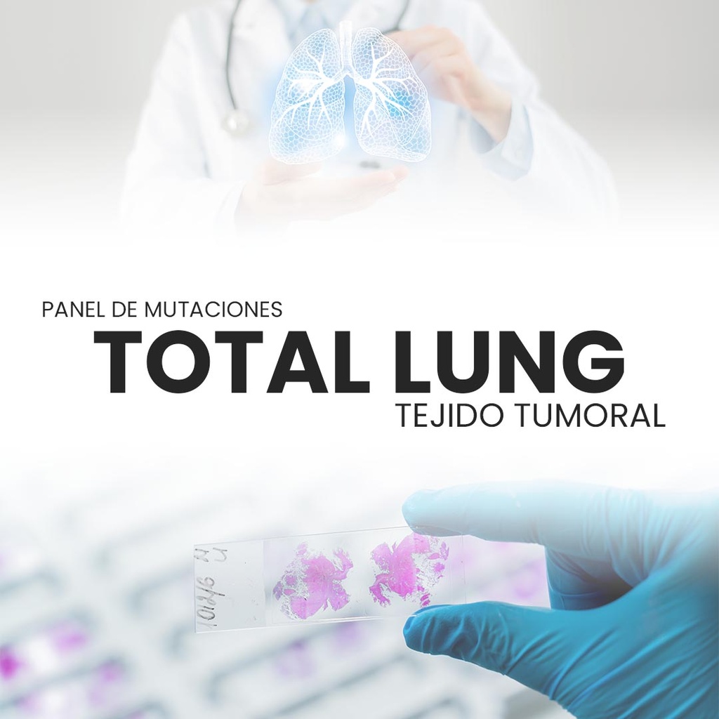 Panel de mutaciones pulmón - Total Lung 