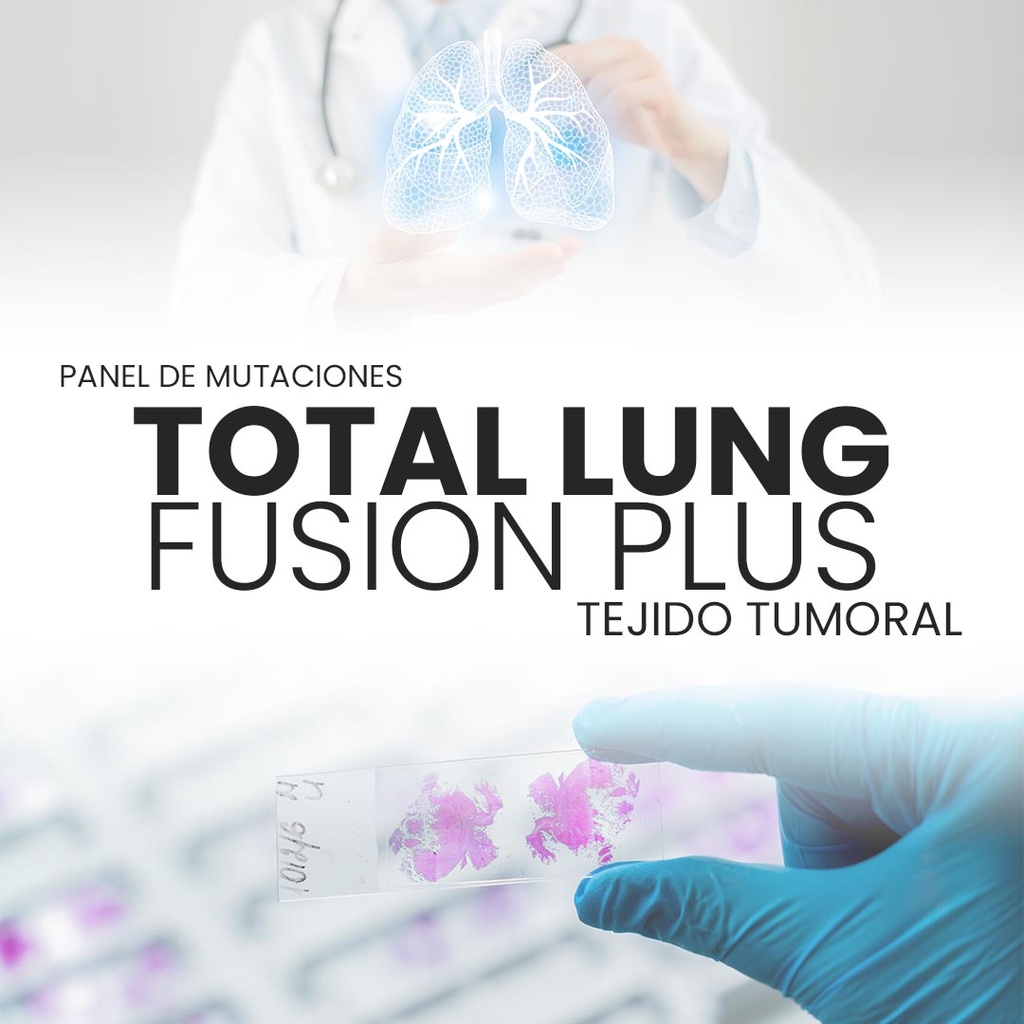 Panel de mutaciones pulmón - Total Lung Fusion Plus (Tejido tumoral)