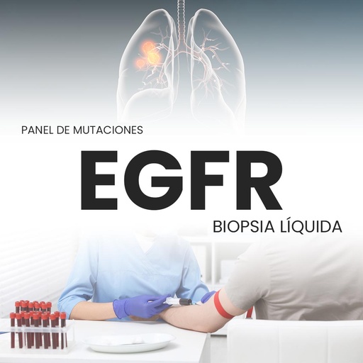 [EGFR-PRI-40-02] Panel de mutaciones EGFR (Biopsia Líquida)