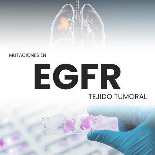 [EGFR-PRI-40-10] Mutaciones en EGFR (Tejido tumoral)