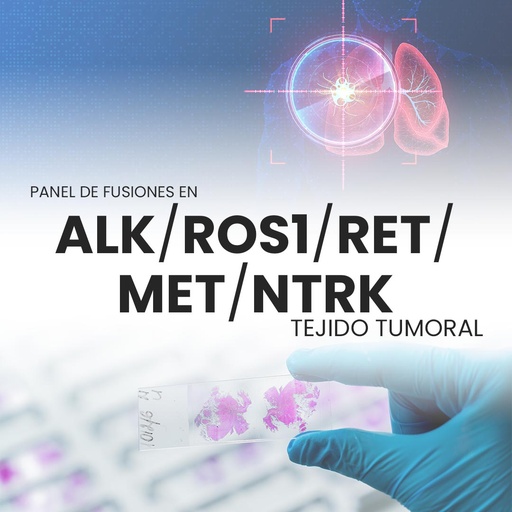 [PF-PRI-40-10] Panel de fusiones en ALK/ROS1/RET/MET y NTRK (Tejido tumoral)