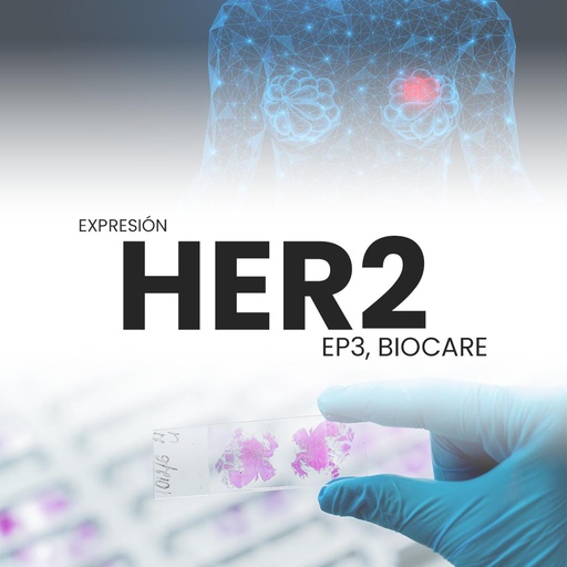[HER2EP3-PRI-15-10] Expresión HER2 (EP3, BioCare)