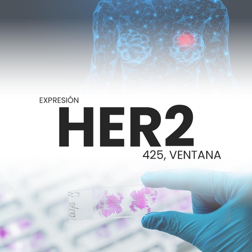 [HER2TEST-PRI-15-10] Expresión HER2 (4B5, Ventana)