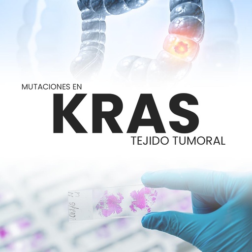 [KRAS-PRI-40-10] Mutaciones en KRAS (Tejido tumoral)