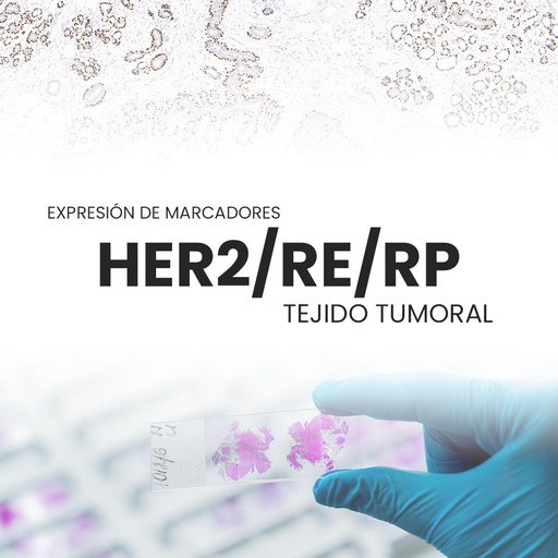 [BREST-PRI-15-10] Expresión de marcadores HER2/RE/RP (Tejido tumoral)