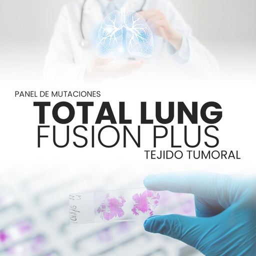 [TLUNGPLUS-PRI-29-10] Total Lung Fusion Plus